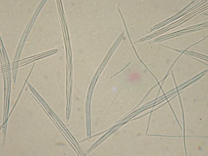 macrostoma