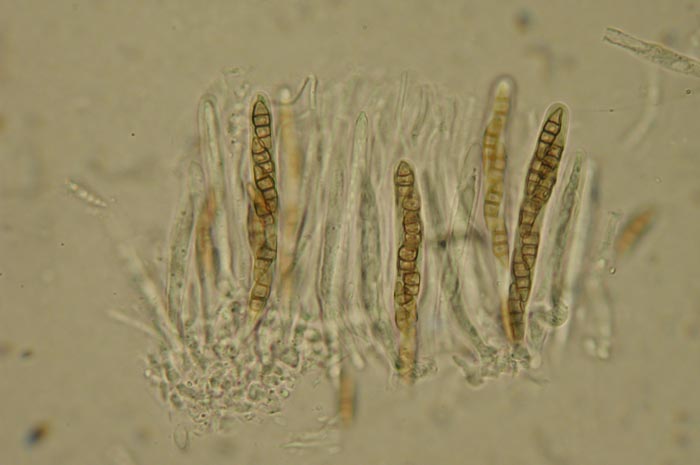 macrostoma
