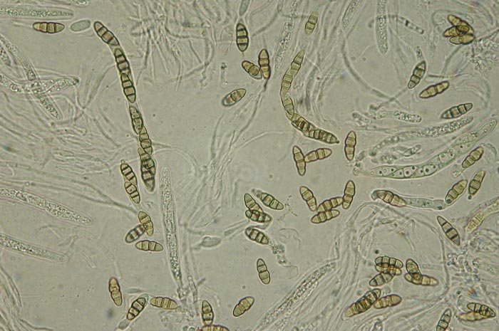macrostoma