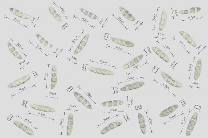 macrostoma