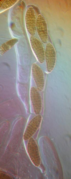macrostoma