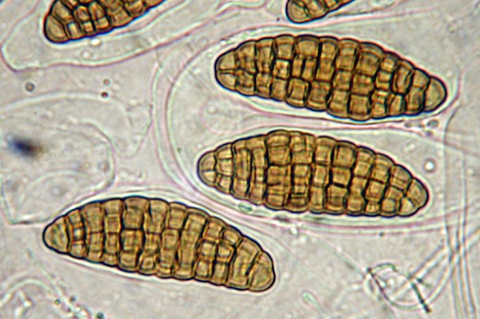 macrostoma
