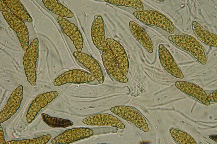 macrostoma