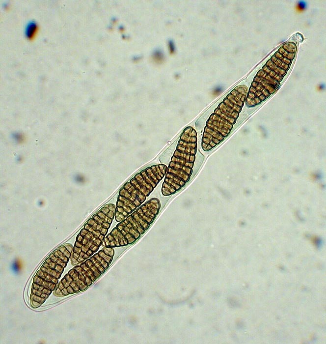 macrostoma