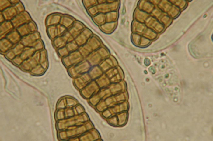 macrostoma