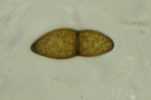 macrostoma