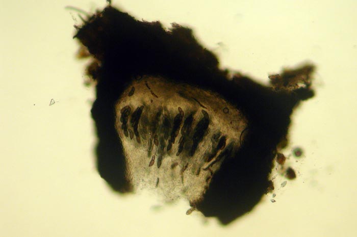 macrostoma