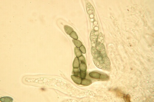 macrostoma