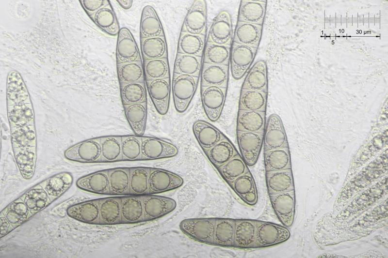 macrostoma