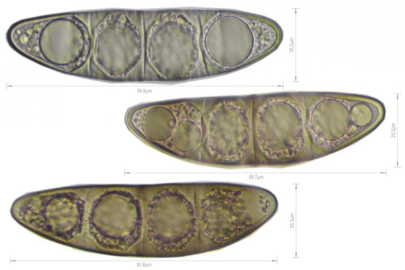 macrostoma