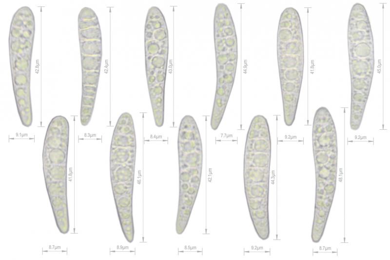 macrostoma
