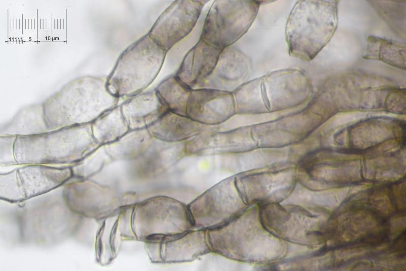 macrostoma