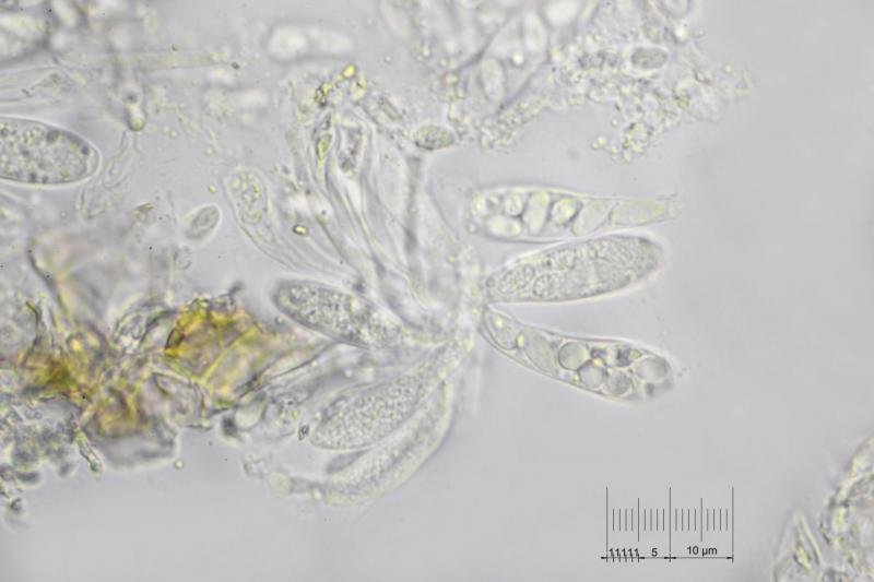 macrostoma