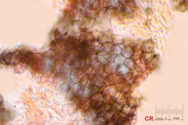 macrostoma