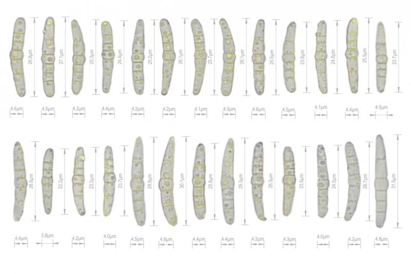 macrostoma