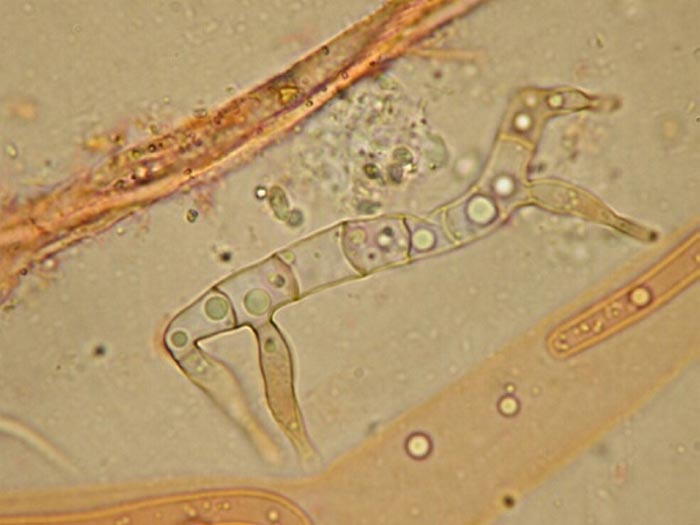 macrostoma