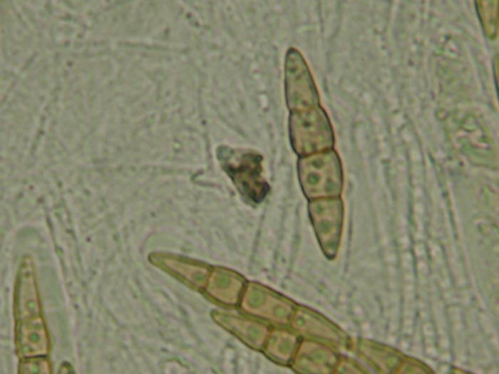 macrostoma