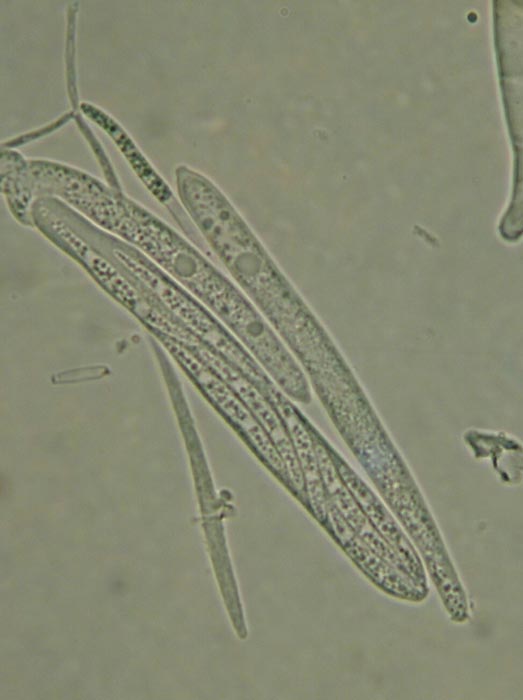 macrostoma