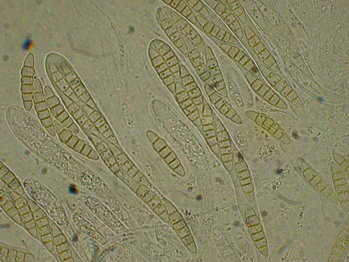 macrostoma