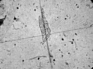 macrostoma