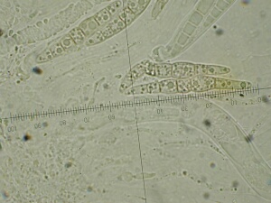 macrostoma