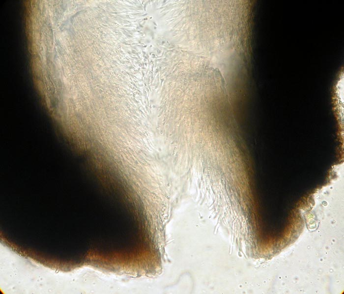 macrostoma