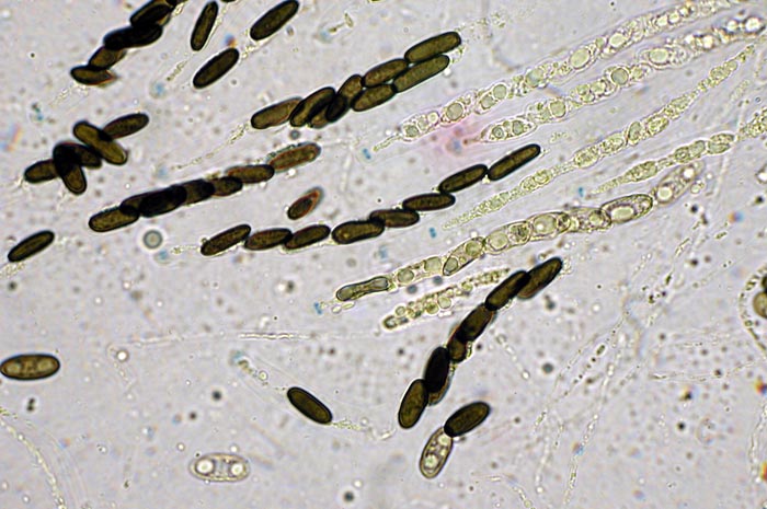 macrostoma