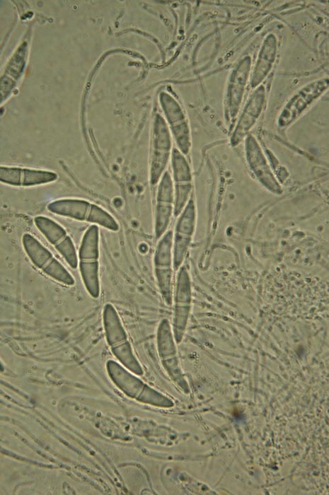 macrostoma