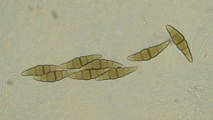 macrostoma