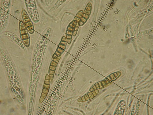 macrostoma