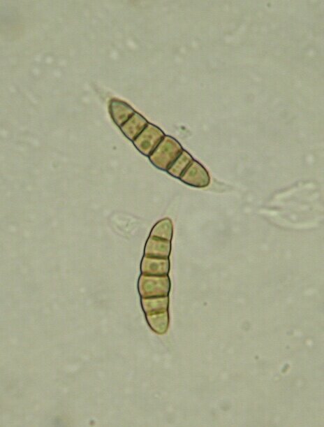 macrostoma