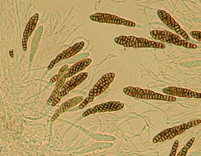 macrostoma