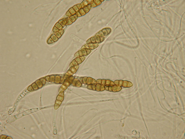 macrostoma