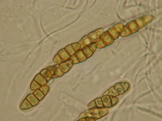 macrostoma