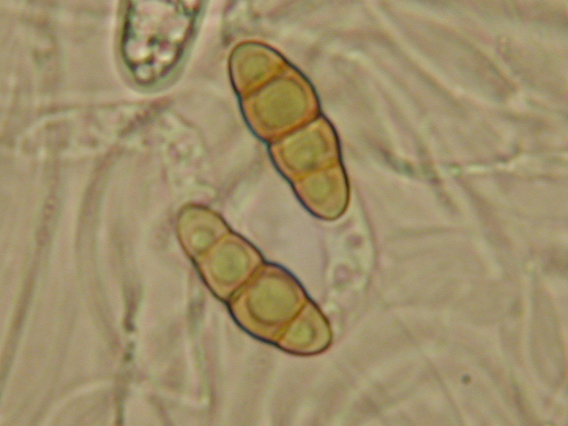 macrostoma