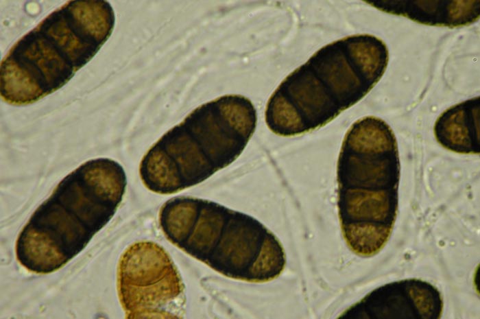 macrostoma