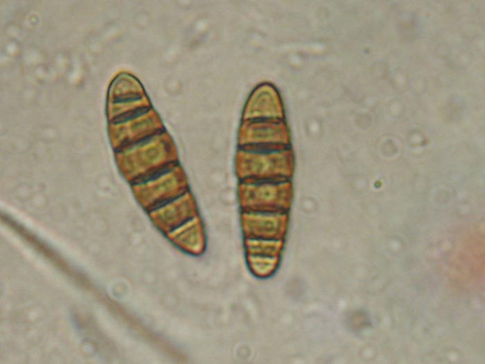 macrostoma