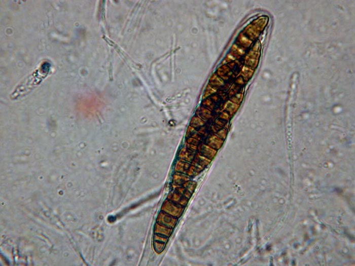 macrostoma