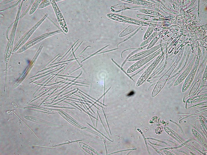 macrostoma
