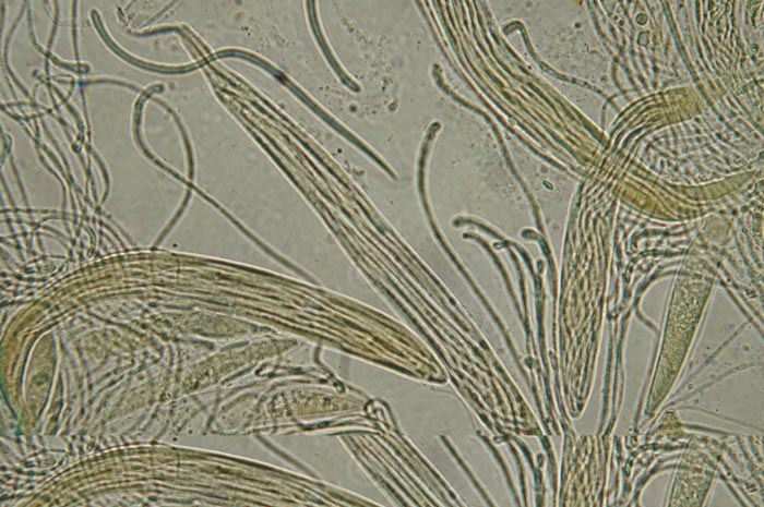 macrostoma