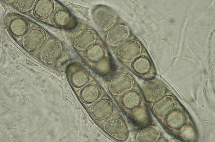 macrostoma