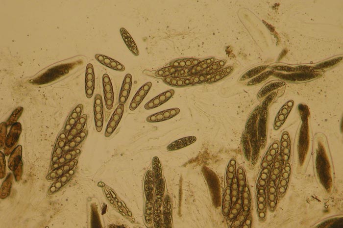 macrostoma