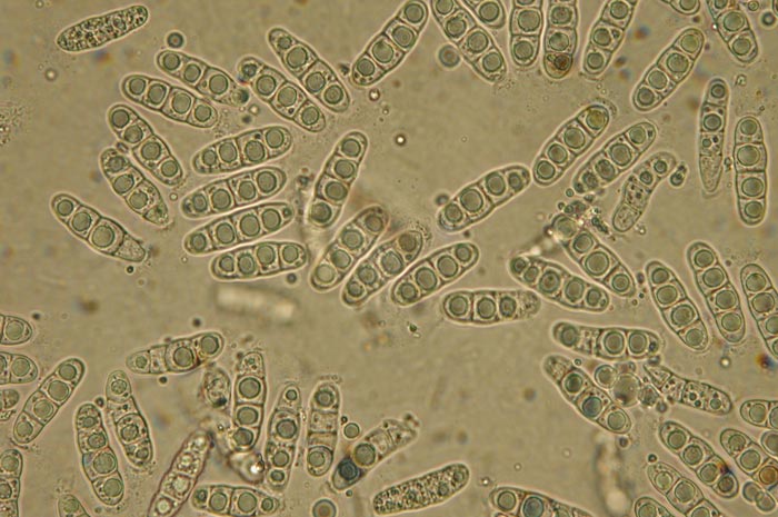 macrostoma