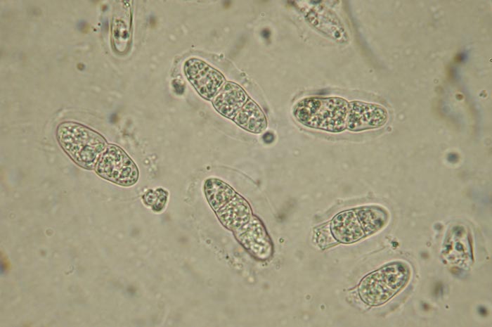 macrostoma