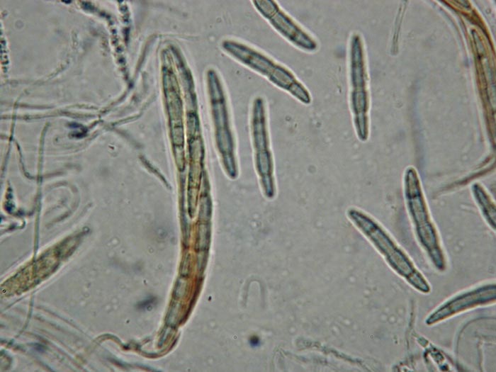 macrostoma