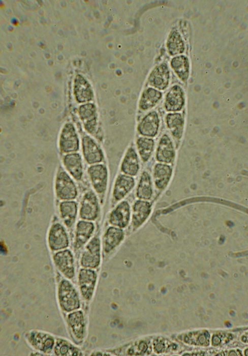 macrostoma