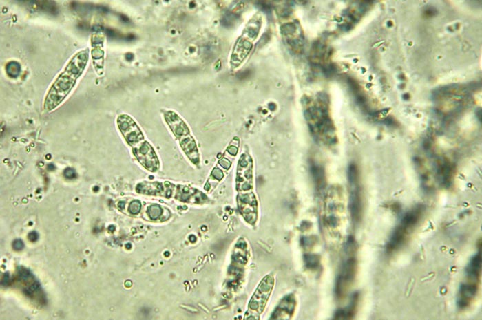macrostoma