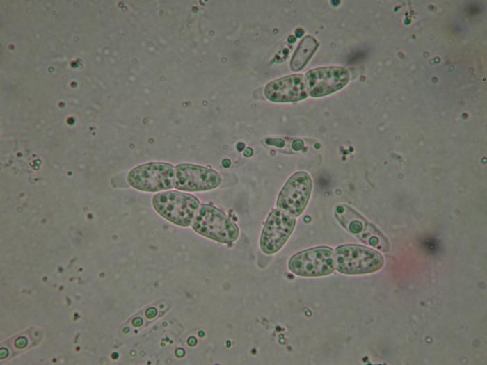 macrostoma