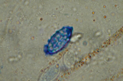 macrostoma