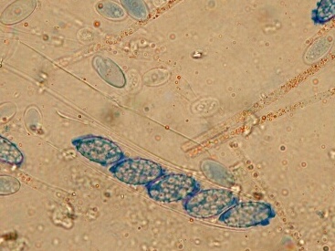 macrostoma